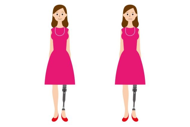 女性義足ユーザーのためのコミュニティ【NPO法人ハイヒール・フラミンゴ】